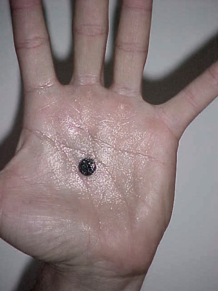 Print by Douglas Gordon