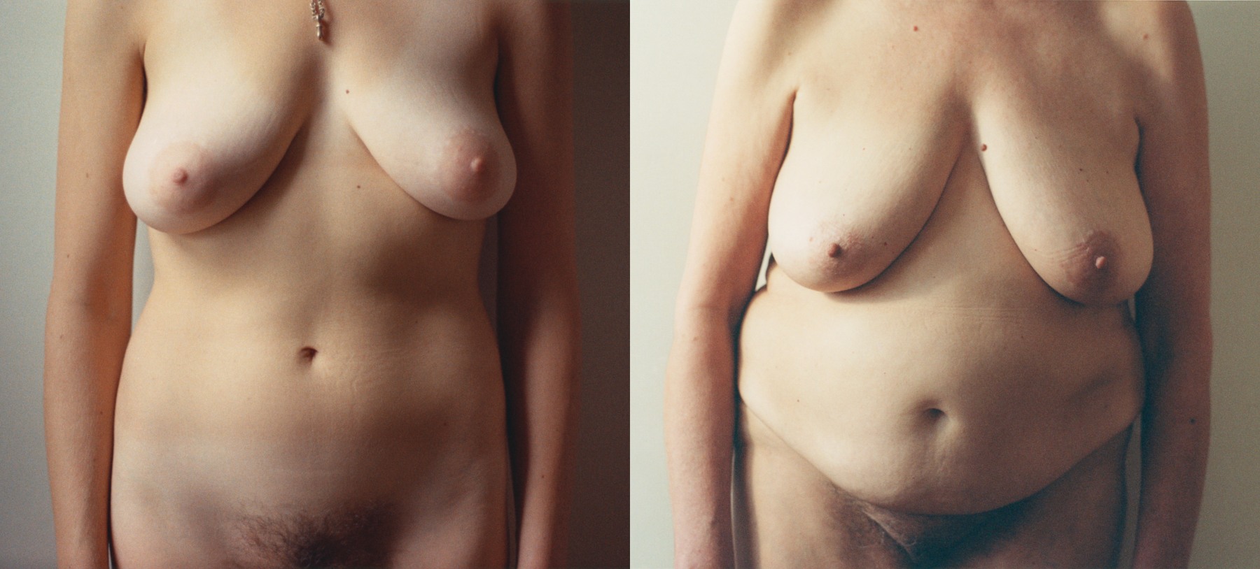 Martha Wilson
Before and After, 1974 and 2008
color photographs, text
26 x 68 ins.
66.4 x 172.72 cm
3/5 (#3/5)&amp;nbsp;
&amp;nbsp;