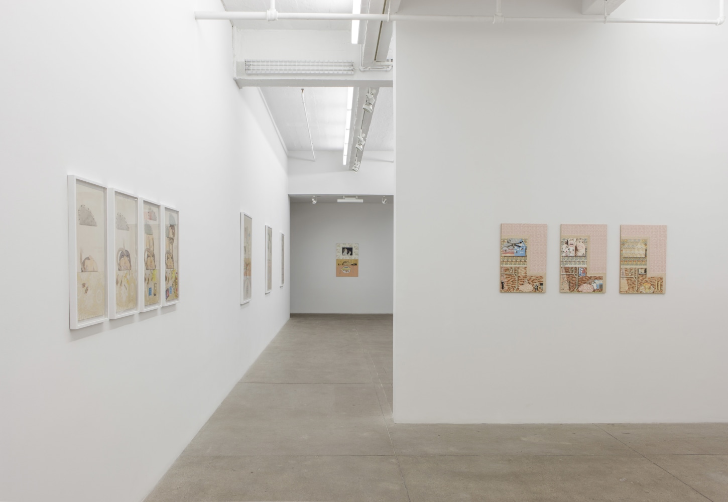 Elsewhere, install 5