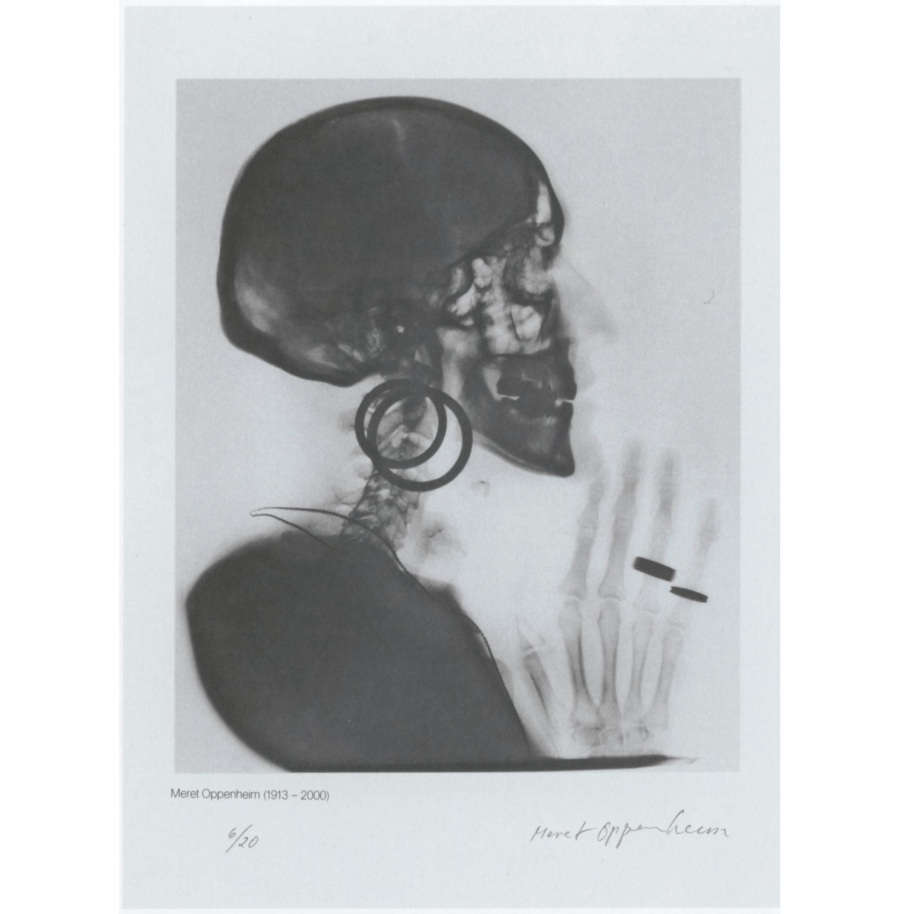 X-Ray of Meret Oppenheim's Skull - From the Research Department - Viewing Room - From the Research Department