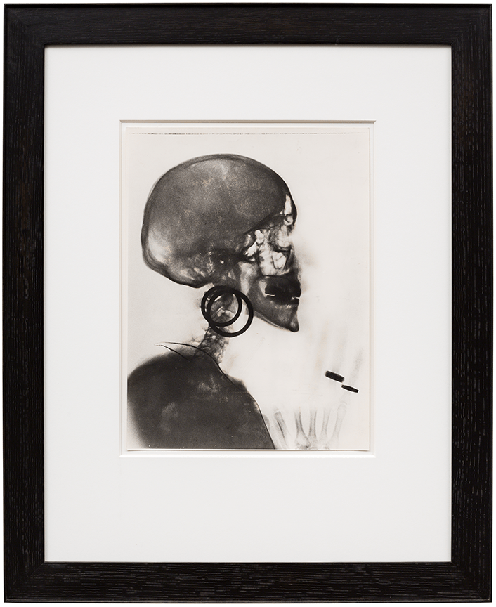 X-Ray of Meret Oppenheim's Skull - From the Research Department - Viewing Room - From the Research Department