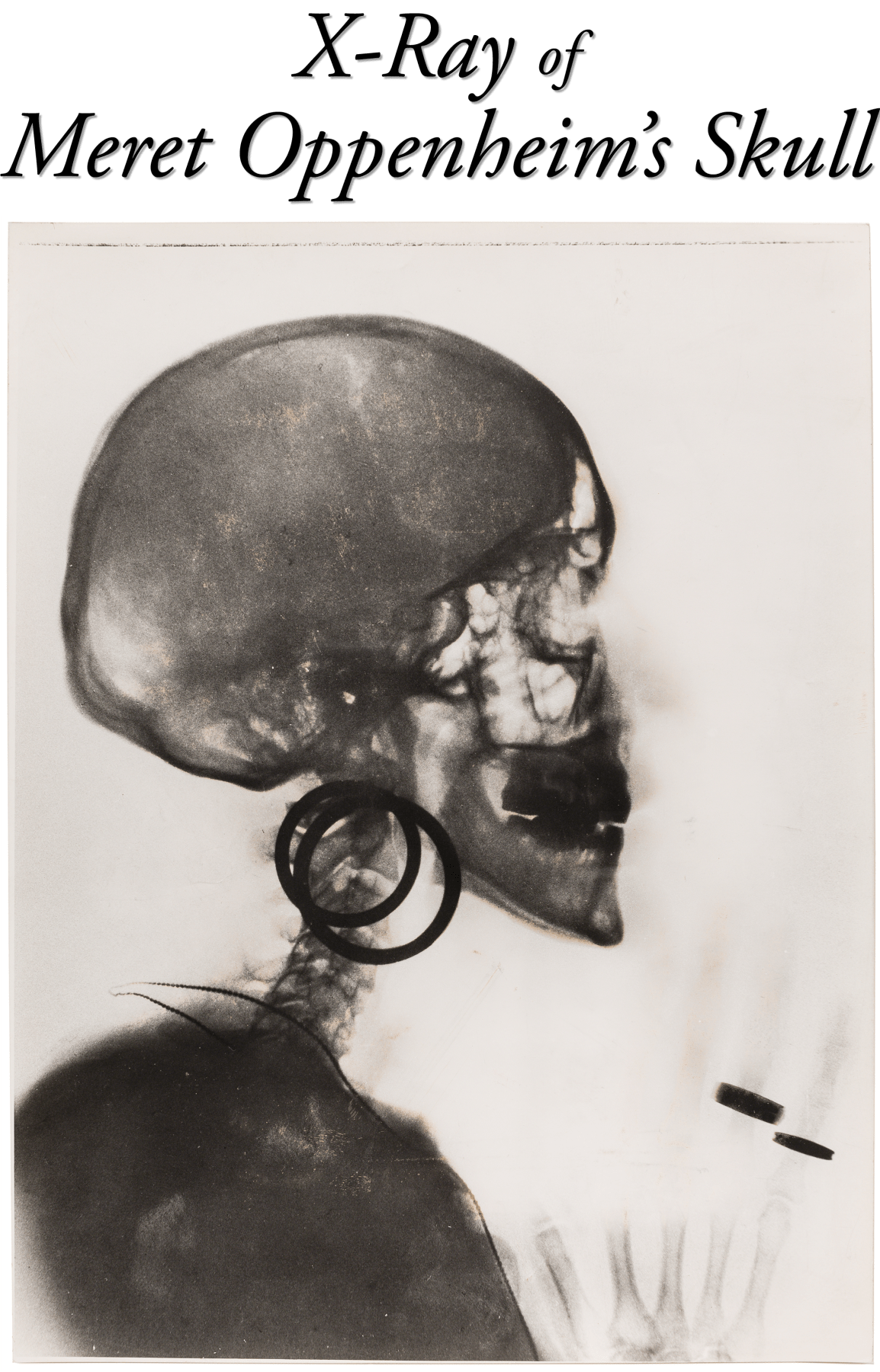 X-Ray of Meret Oppenheim's Skull - From the Research Department - Viewing Room - From the Research Department