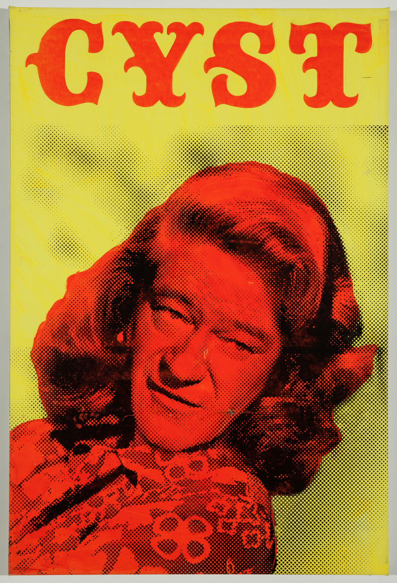 SKYLAR FEIN Cyst, 2013