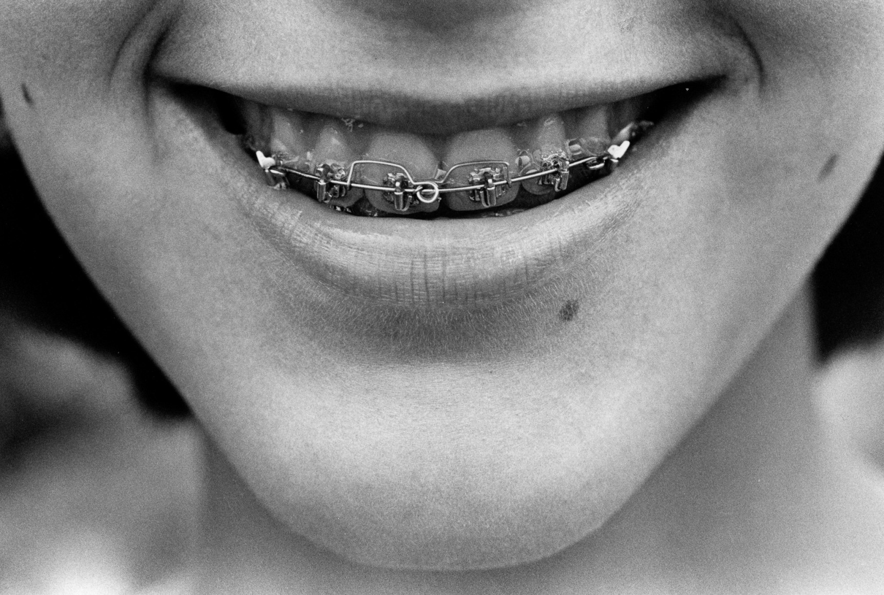 Gerard Malanga, Fer sure, fer sure, 1980