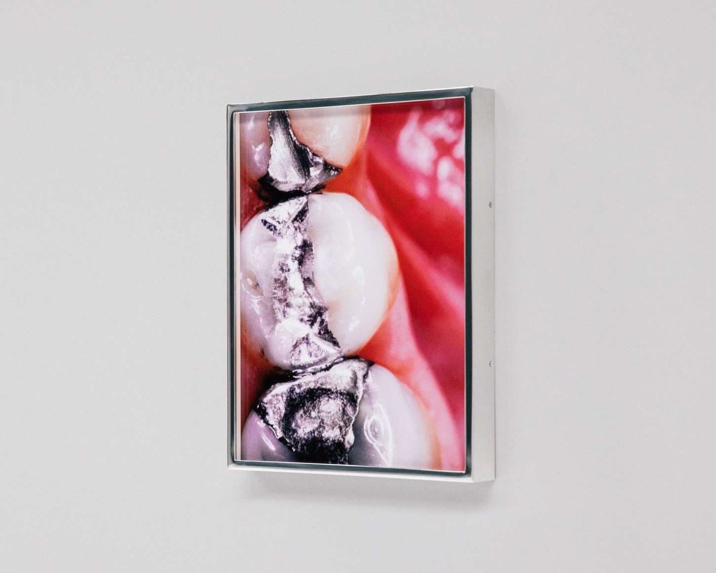 Elad Lassry, Dental Fillings, 2016