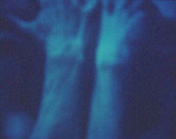 Reverie No. 22, 2001