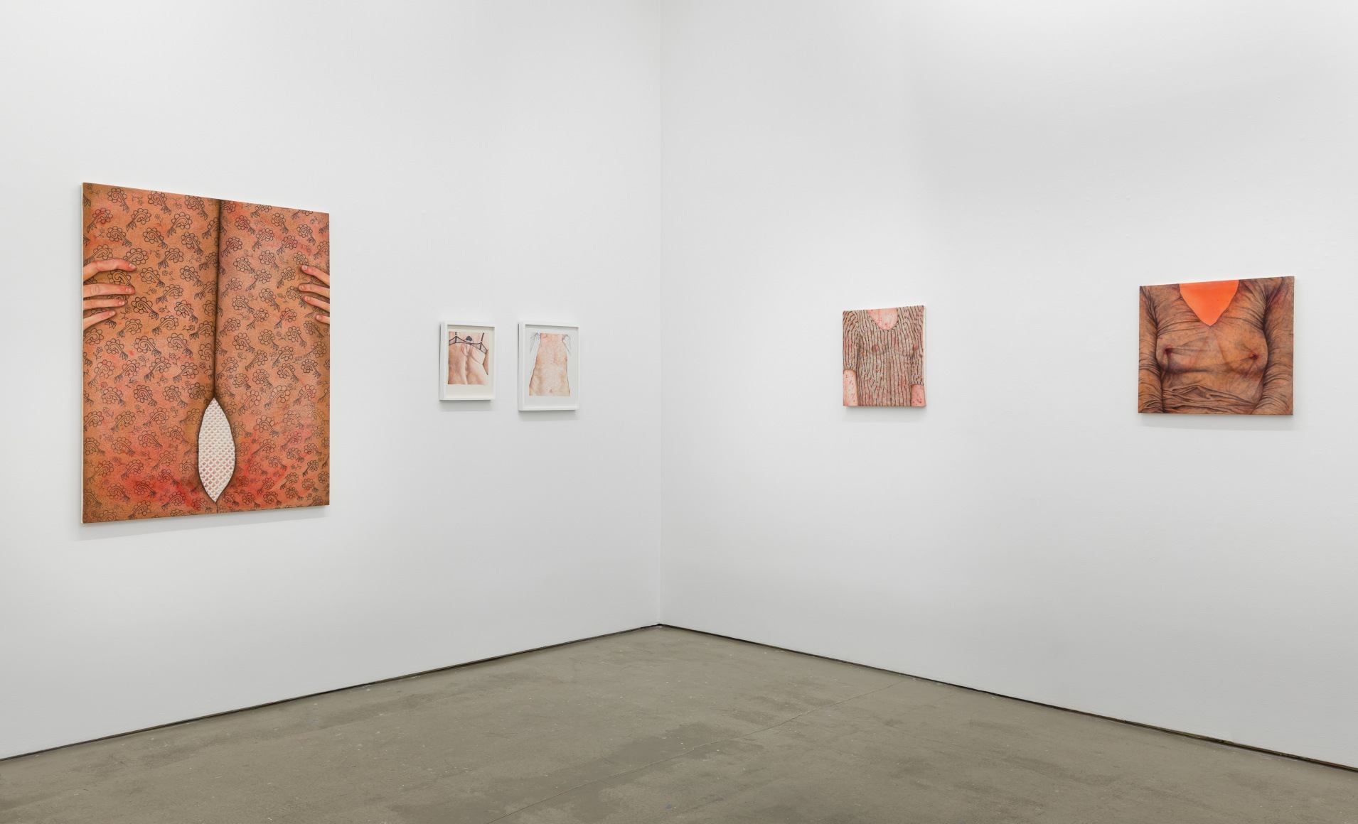 Installation view of exhibition Katarina Riesing, "Razor Burn"