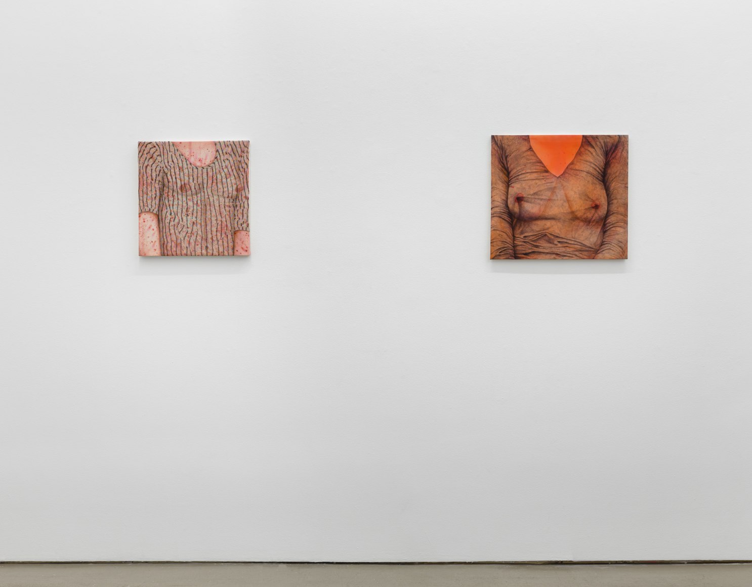 Installation view of exhibition Katarina Riesing, "Razor Burn"