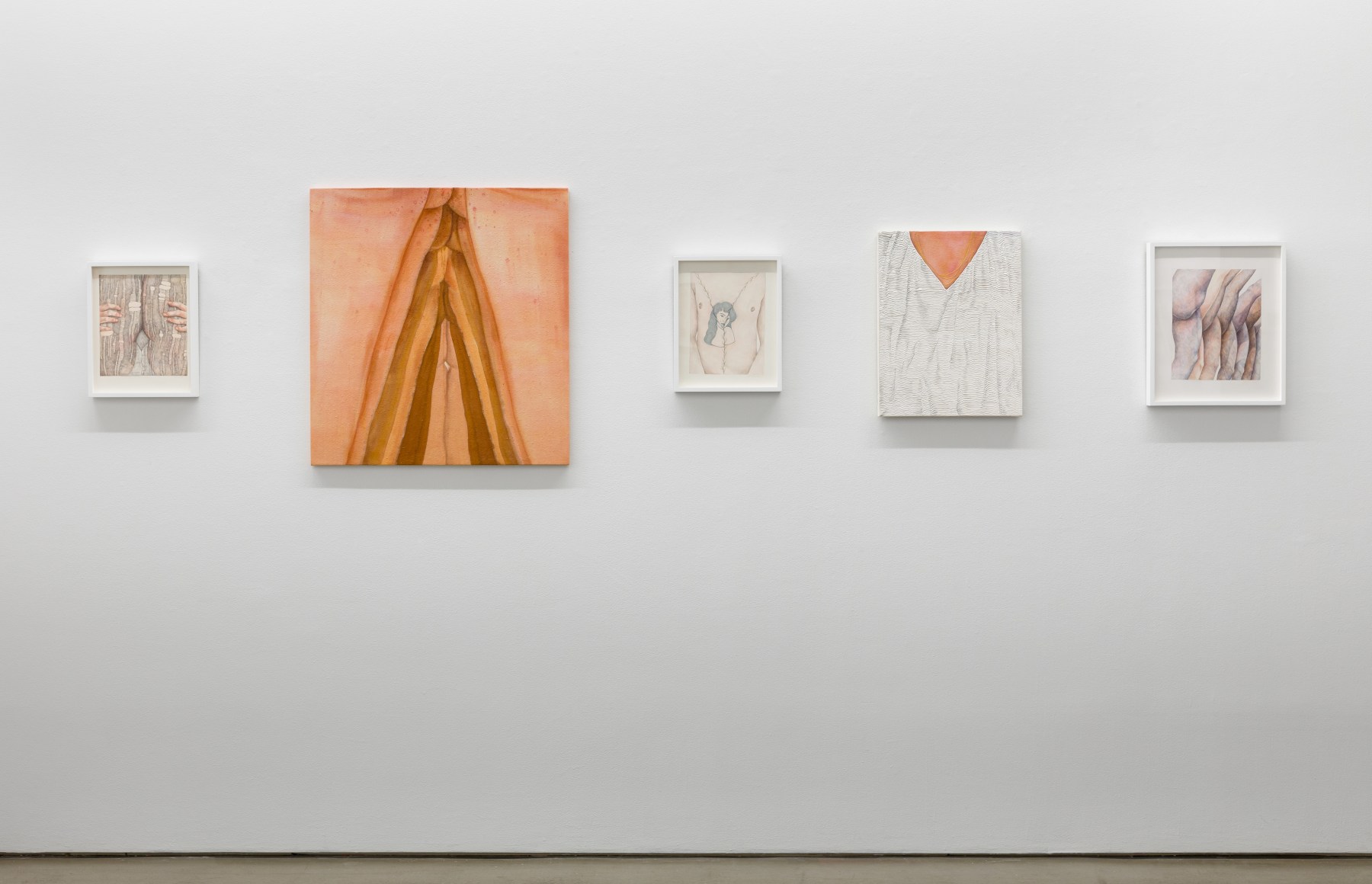 Installation view of exhibition Katarina Riesing, "Razor Burn"