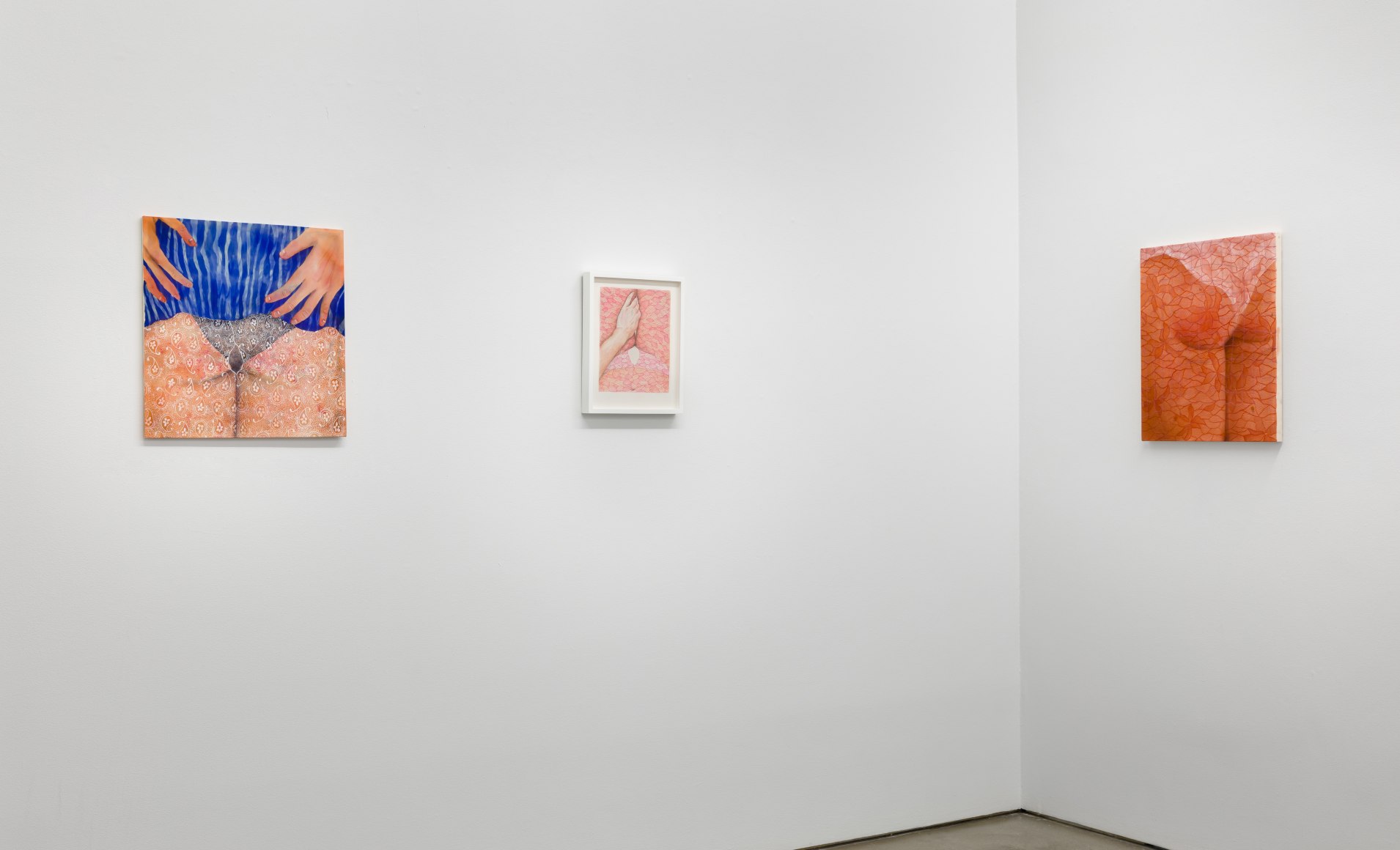 Installation view of exhibition Katarina Riesing, "Razor Burn"