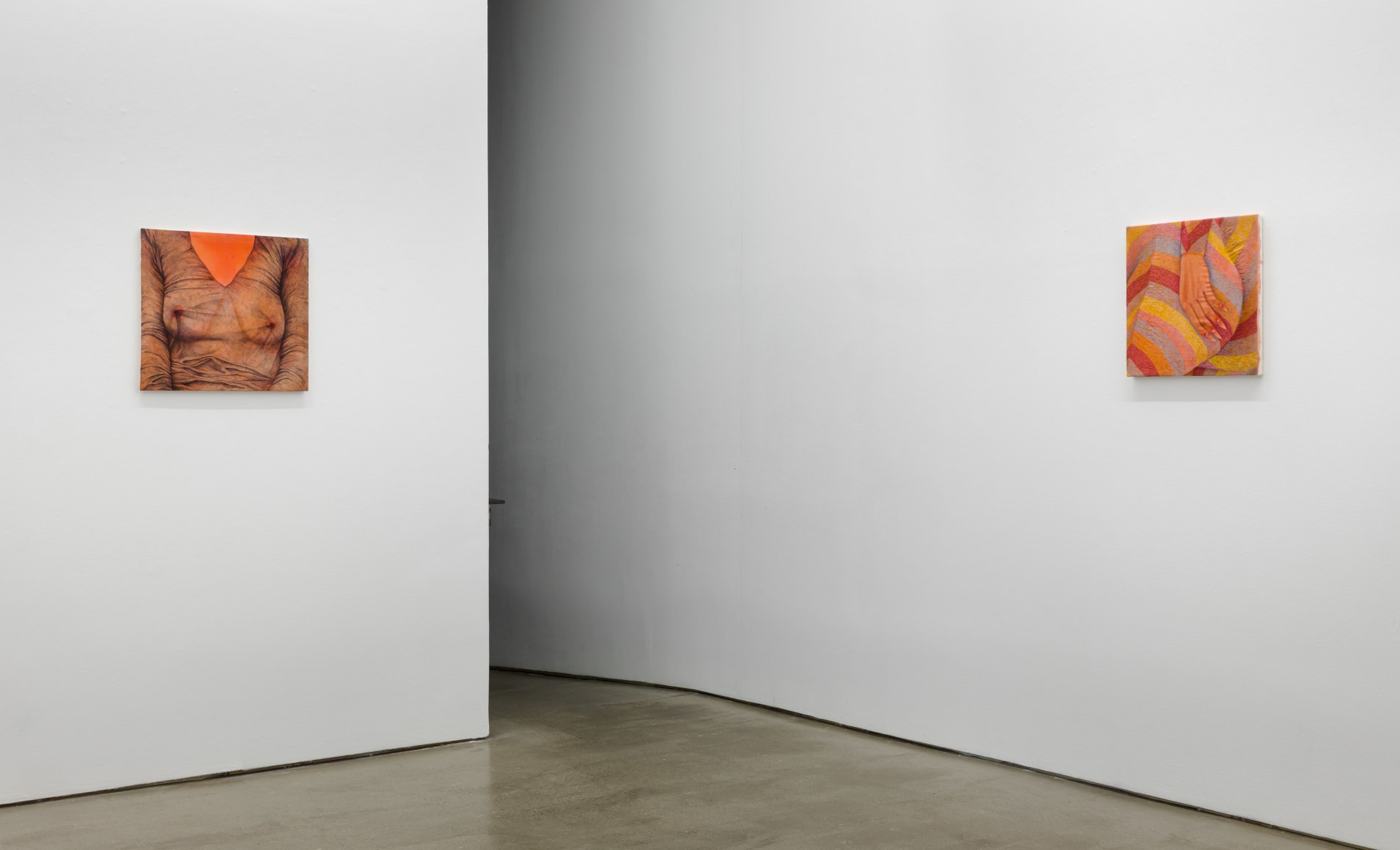 Installation view of exhibition Katarina Riesing, "Razor Burn"