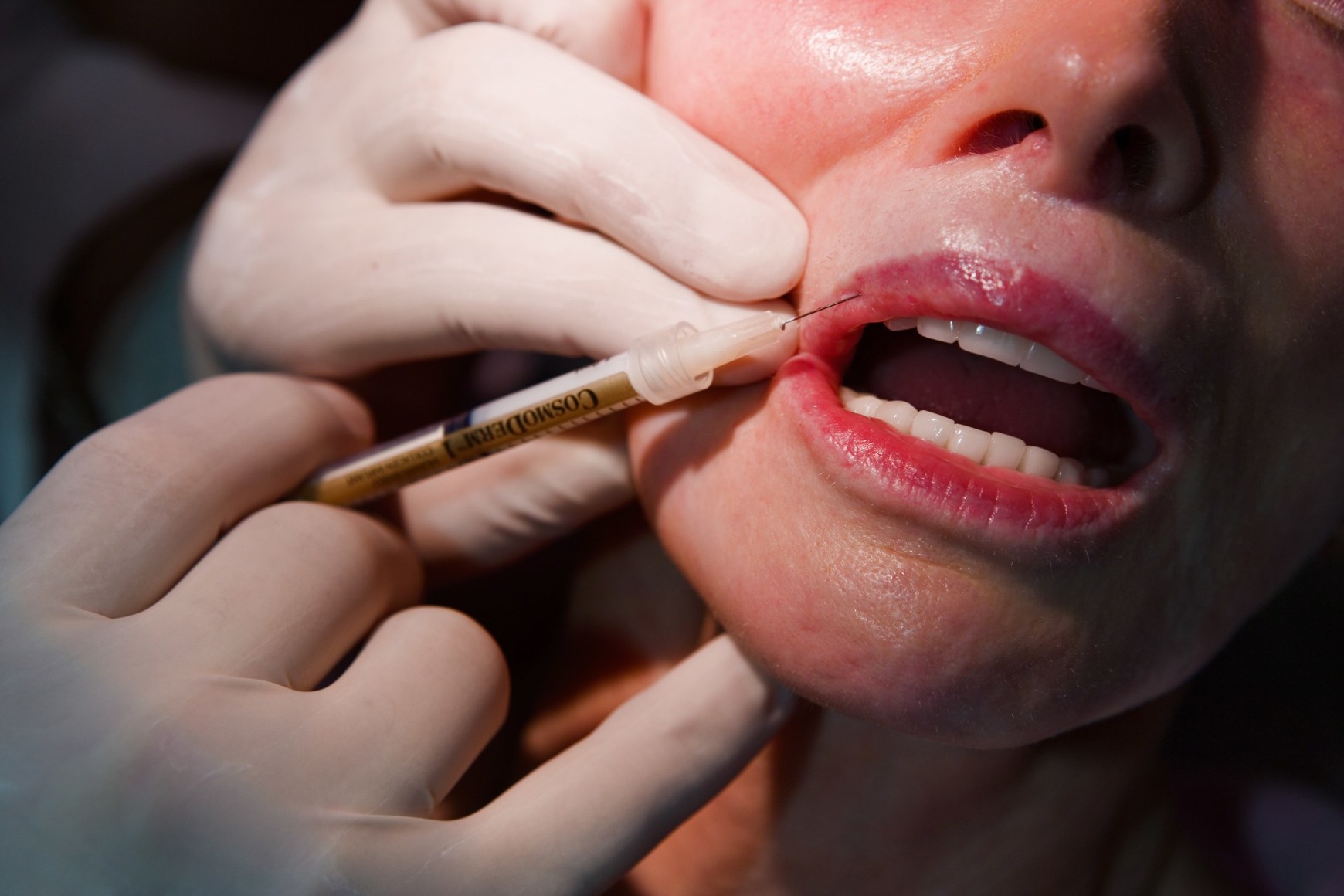 Dermatologist Dr. Arnold Klein, 61, dubbed “the King of Lips,” injects Jackie Goldberg, 72, with collagen, Beverly Hills, 2005, Archival Pigment Print