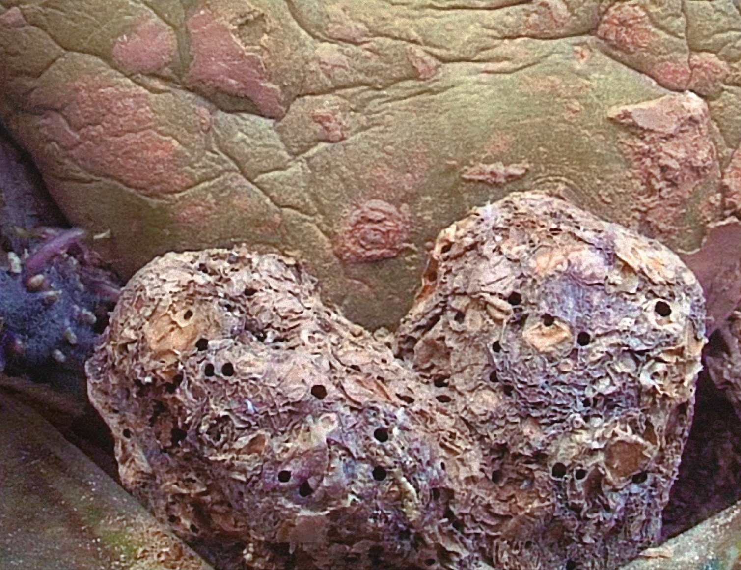 Potato Series, Heart Potato #6, 2002, C-Print, Ed. of 10