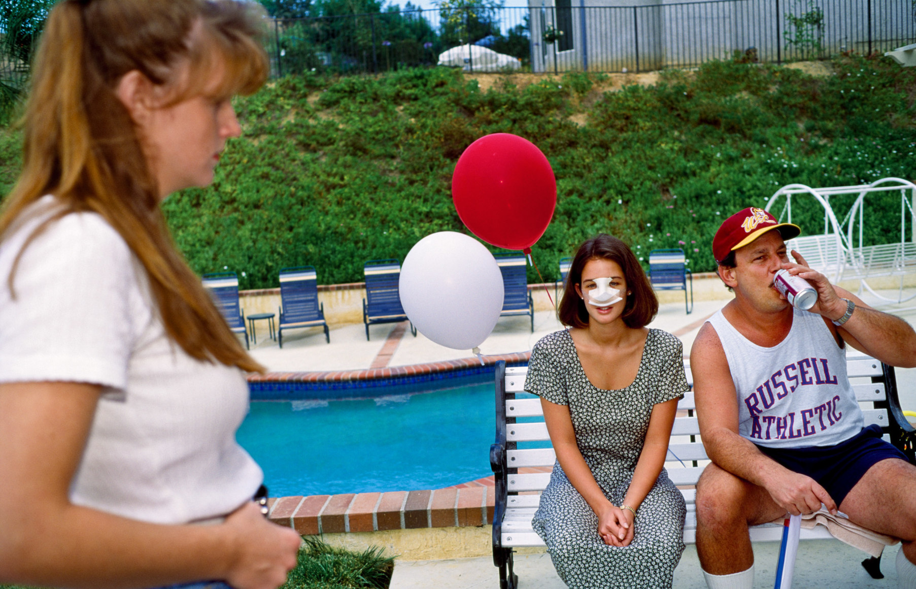 Lindsey, 18, at a Fourth of July party three days after her nose job, Calabasas, California, 1993, Archival Pigment Print