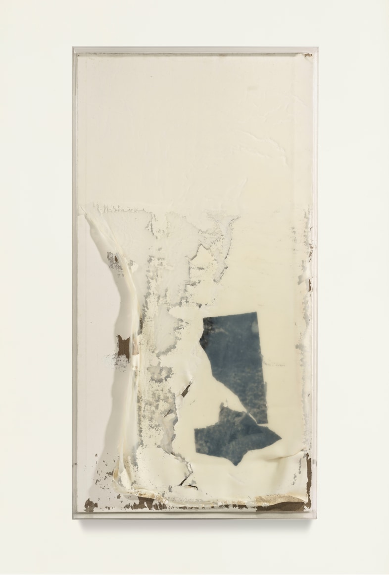 Cataract-6 白内障-6 2017