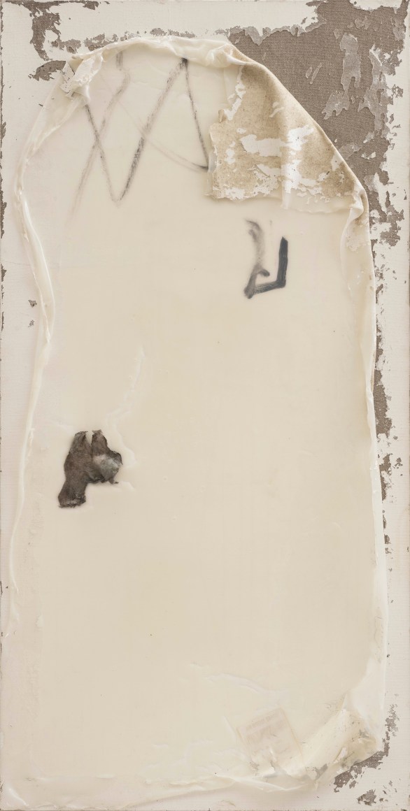 Cataract No.2 白内障 No.2