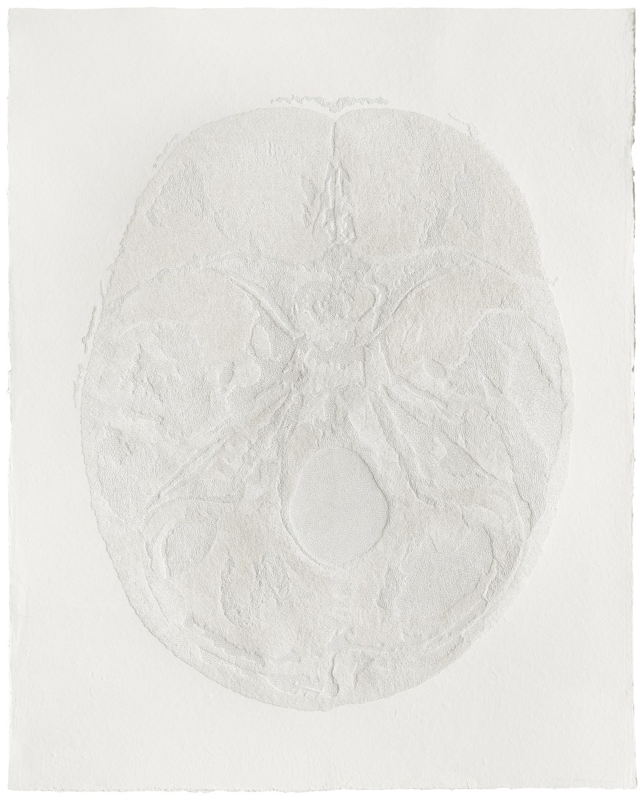 305,440 Pinpricks 305,440 孔, 2015