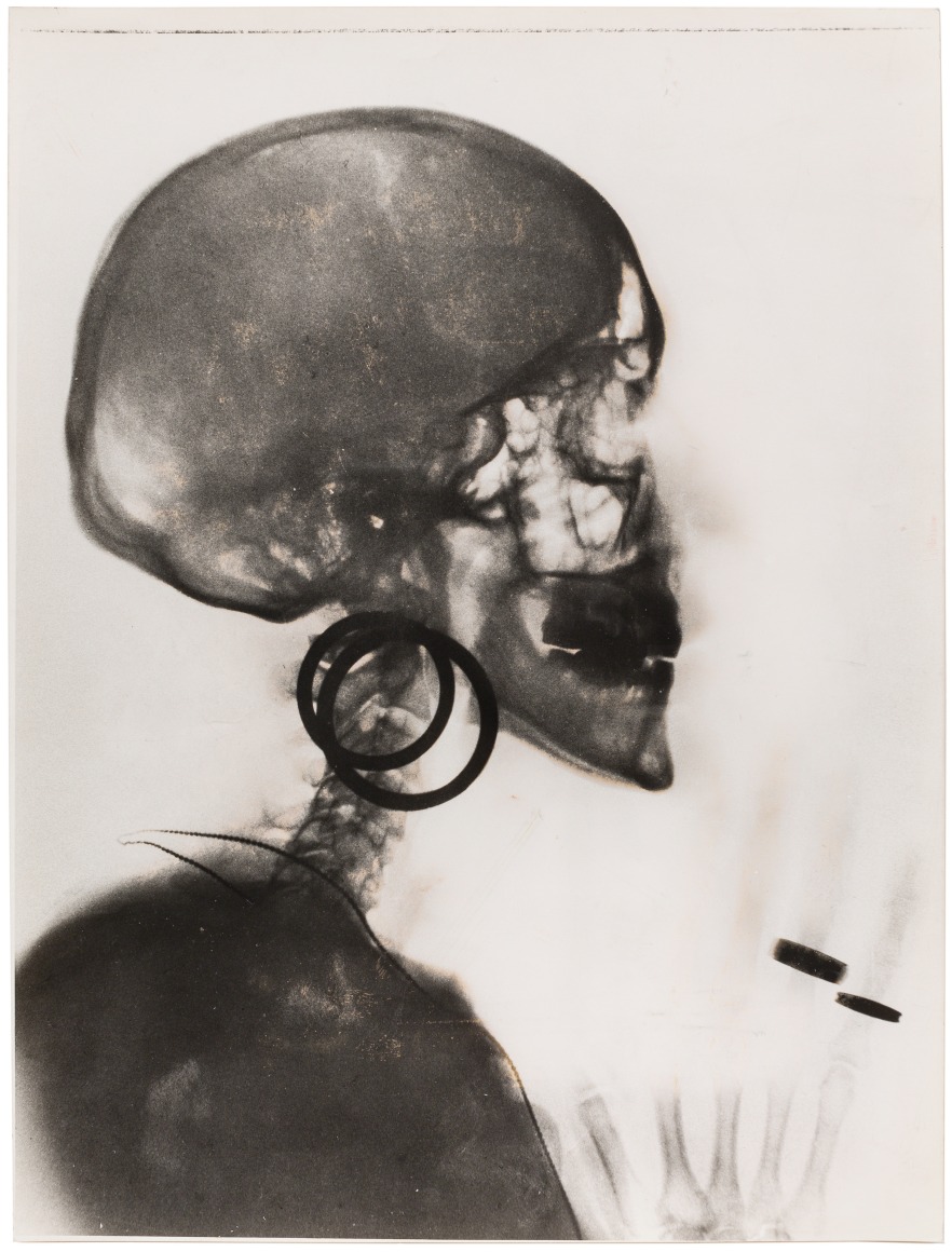 Meret Oppenheim (1913-1985), Röntgenaufnahme des Schädels M.O. / X-Ray of M. O.’s Skull 1964