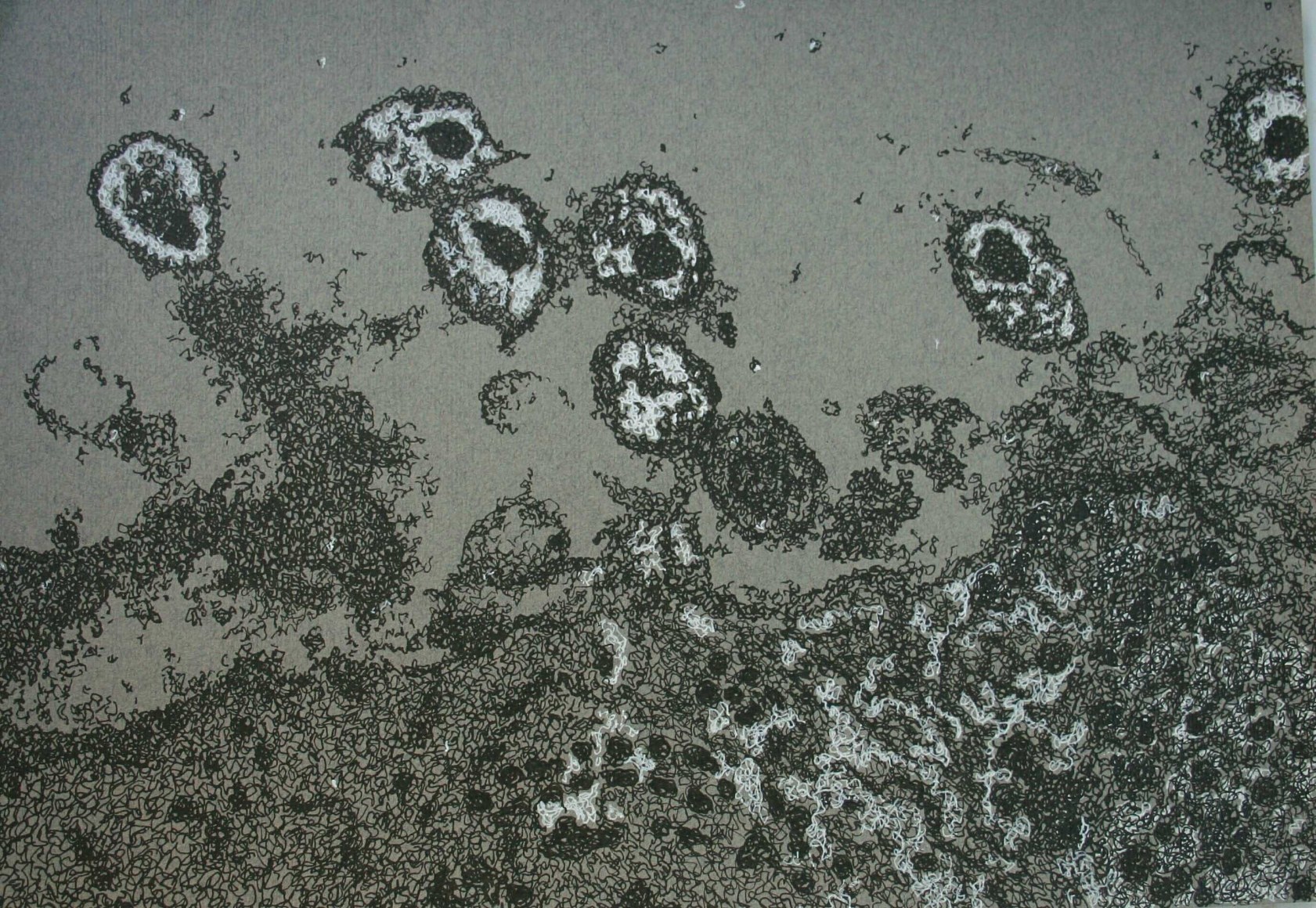 Jody Rasch, Deficiency 8 - HIV