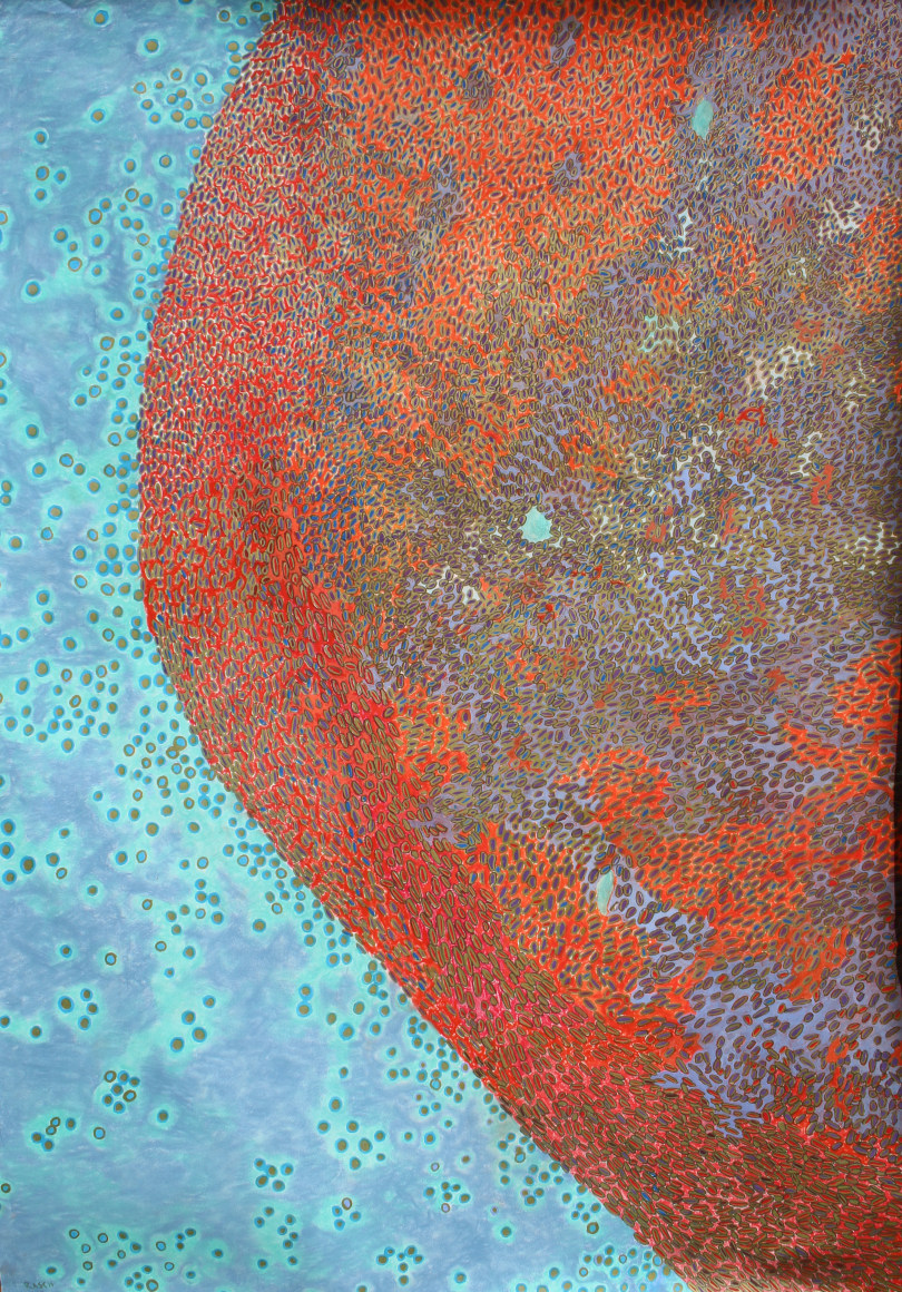 Jody Rasch, Healing 5 - Blood Clot