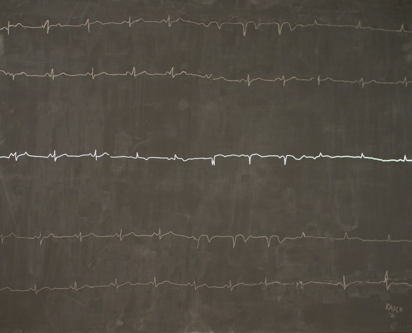 Jody Rasch, Self Potrait - Heartbeat 1