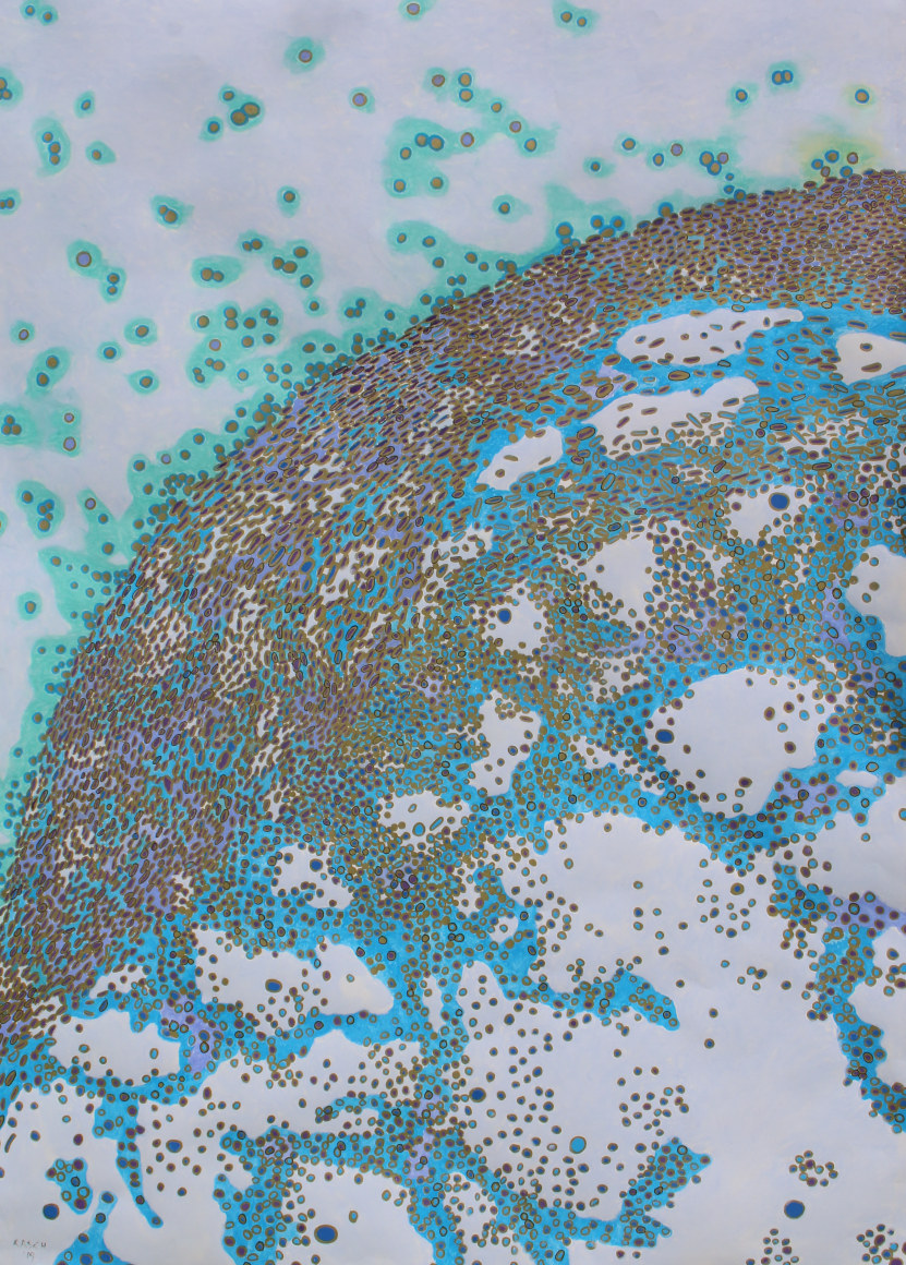 Jody Rasch, Healing 6 - Blood Clot