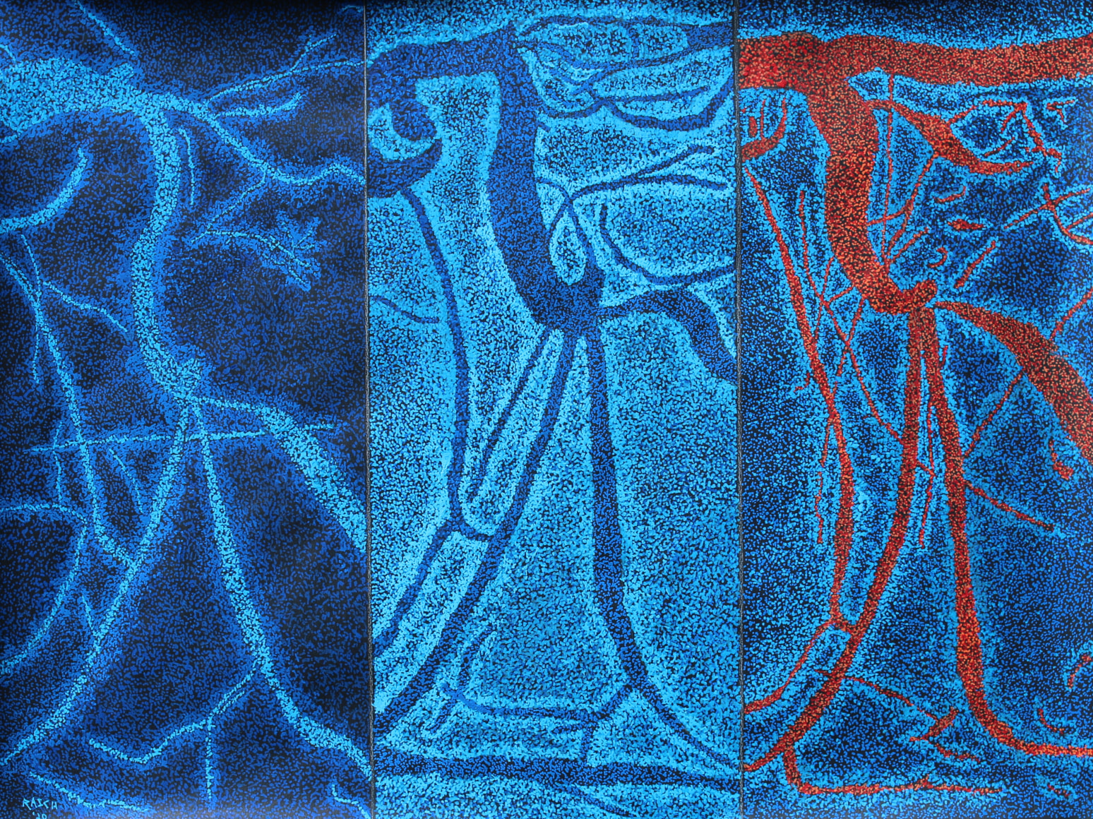 Jody Rasch, Self Portrait 3 - Angiogram