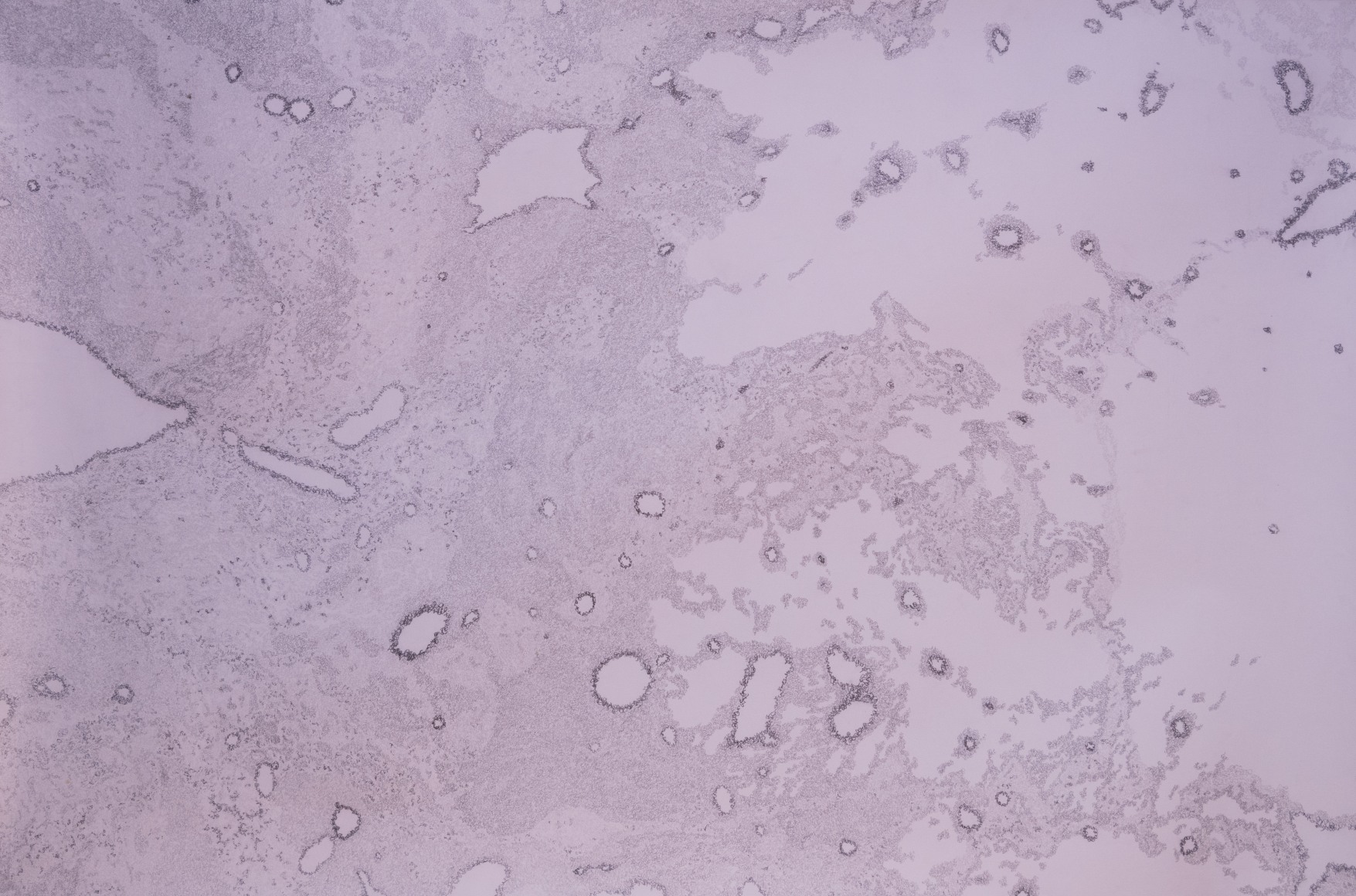 Jody Rasch, Background Radiation