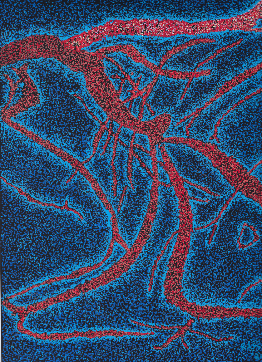 Jody Rasch, Self-Portrait 2 - Angiogram