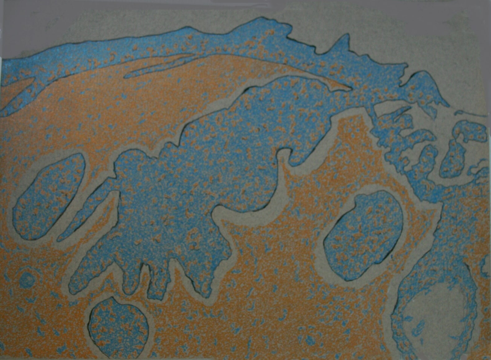 Jody Rasch, Beauty 2 - Basal Cell