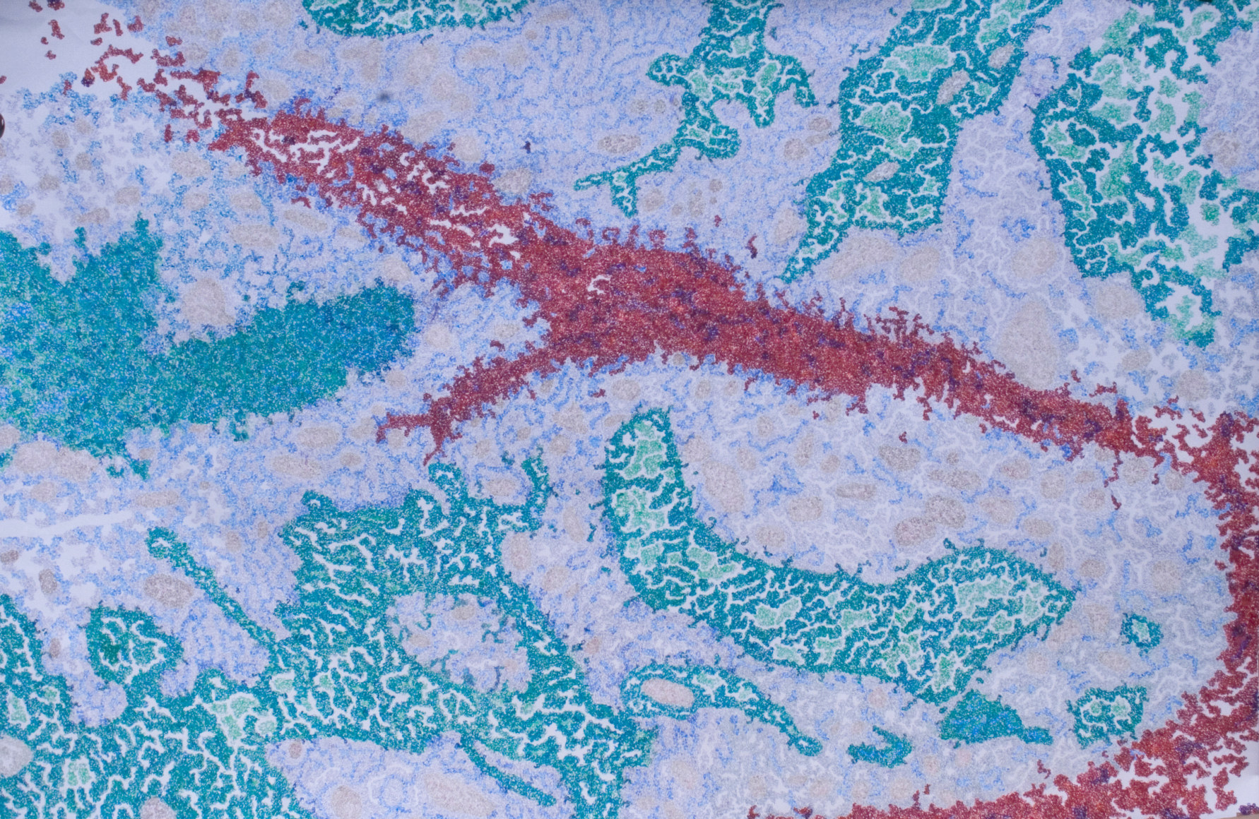 Jody Rasch, Lifeless - Ovarian Cancer