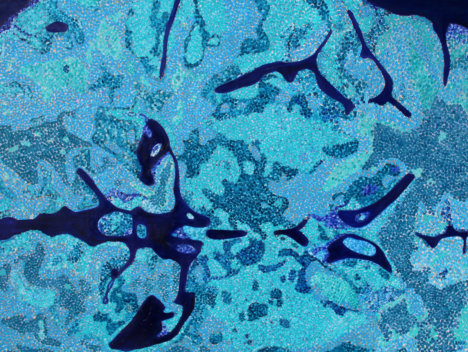 Jody Rasch, Thought - MRI 2