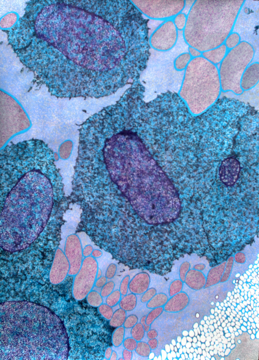 Jody Rasch, Symbiosis 2 - Bacteroidetes