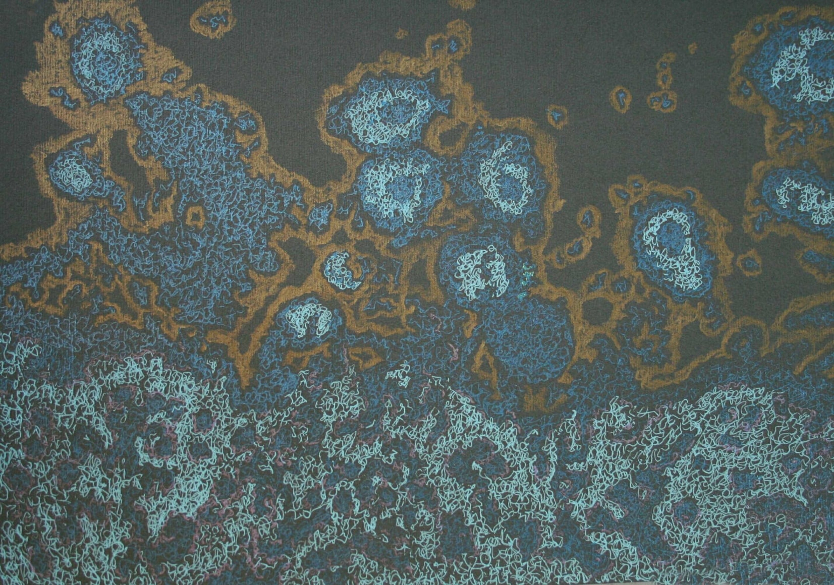 Jody Rasch, Deficiency 7 - HIV