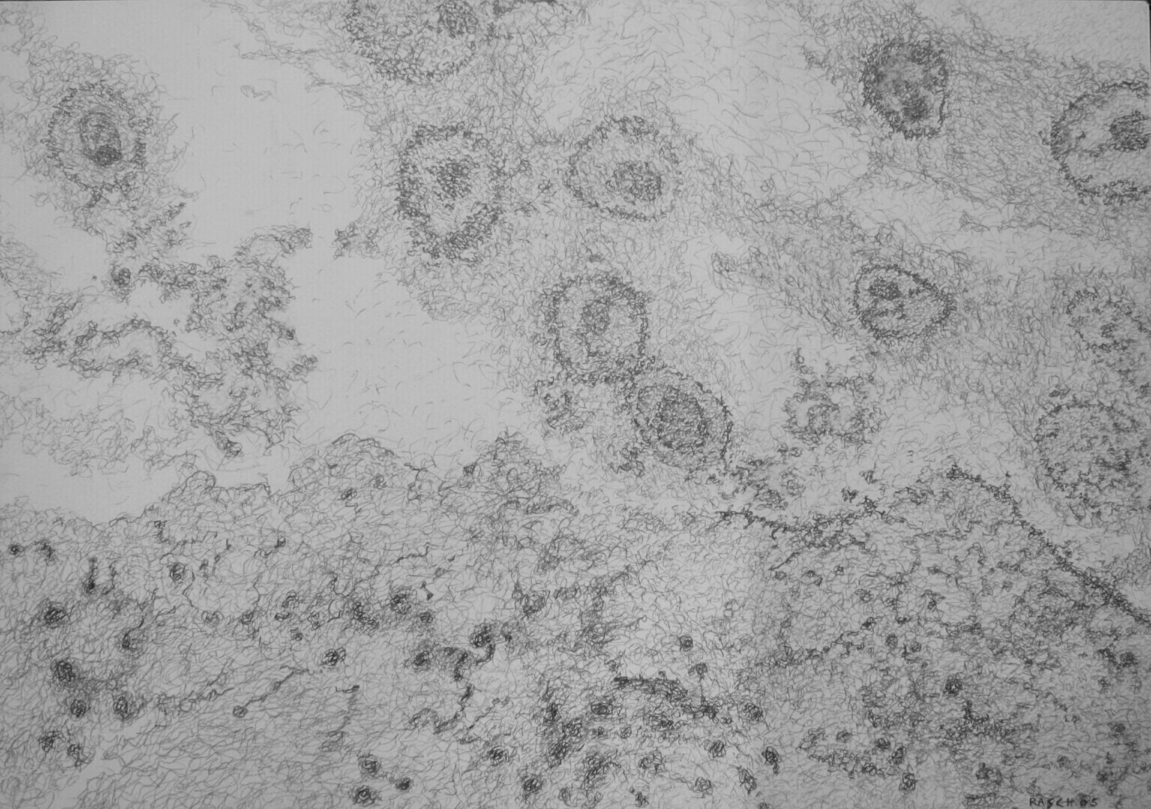 Jody Rasch, Deficiency 4 - HIV