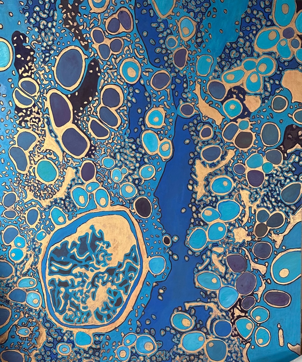 Jody Rasch, Sweet 2 - Diabetes