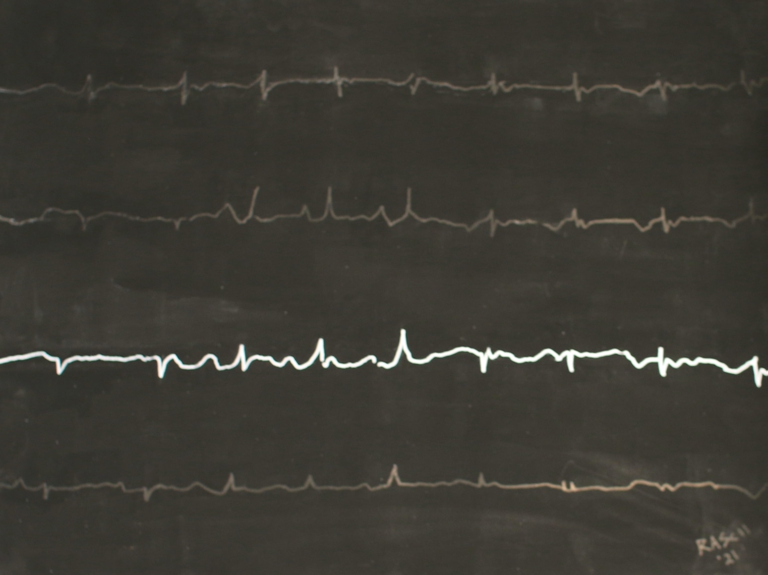 Jody Rasch, Self Portrait - Heartbeat 2
