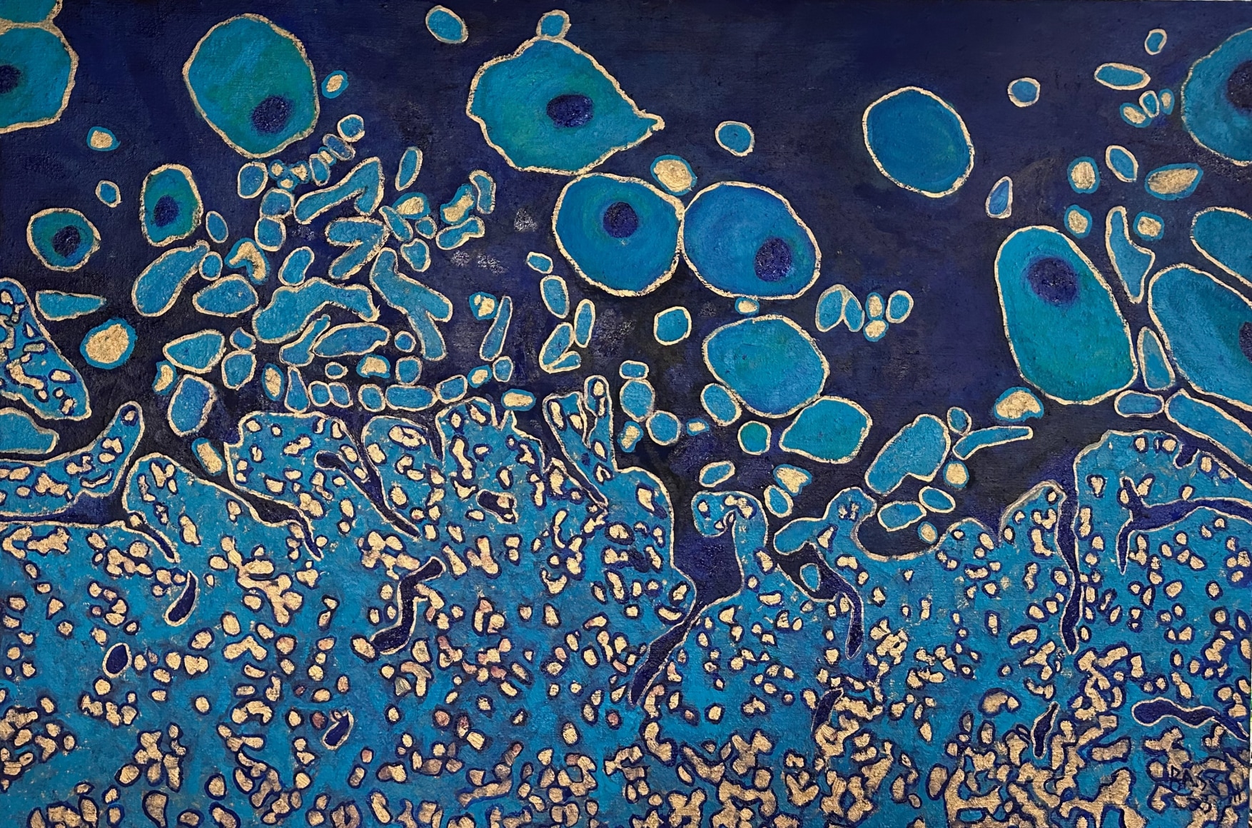 Jody Rasch, Deficiency 11 - HIV