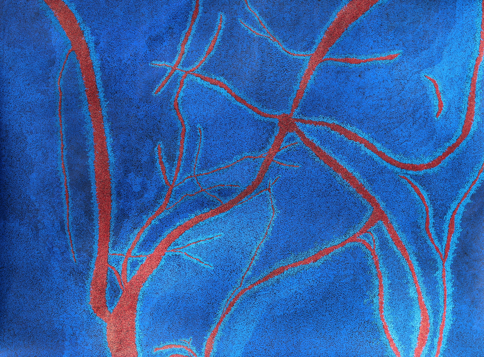 Jody Rasch, Self Portrait 4 - Angiogram