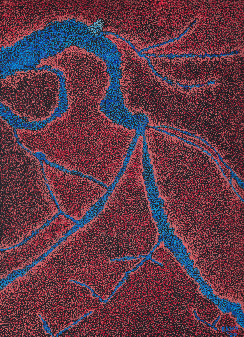 Jody Rasch, Self-Portrait 1 - Angiogram