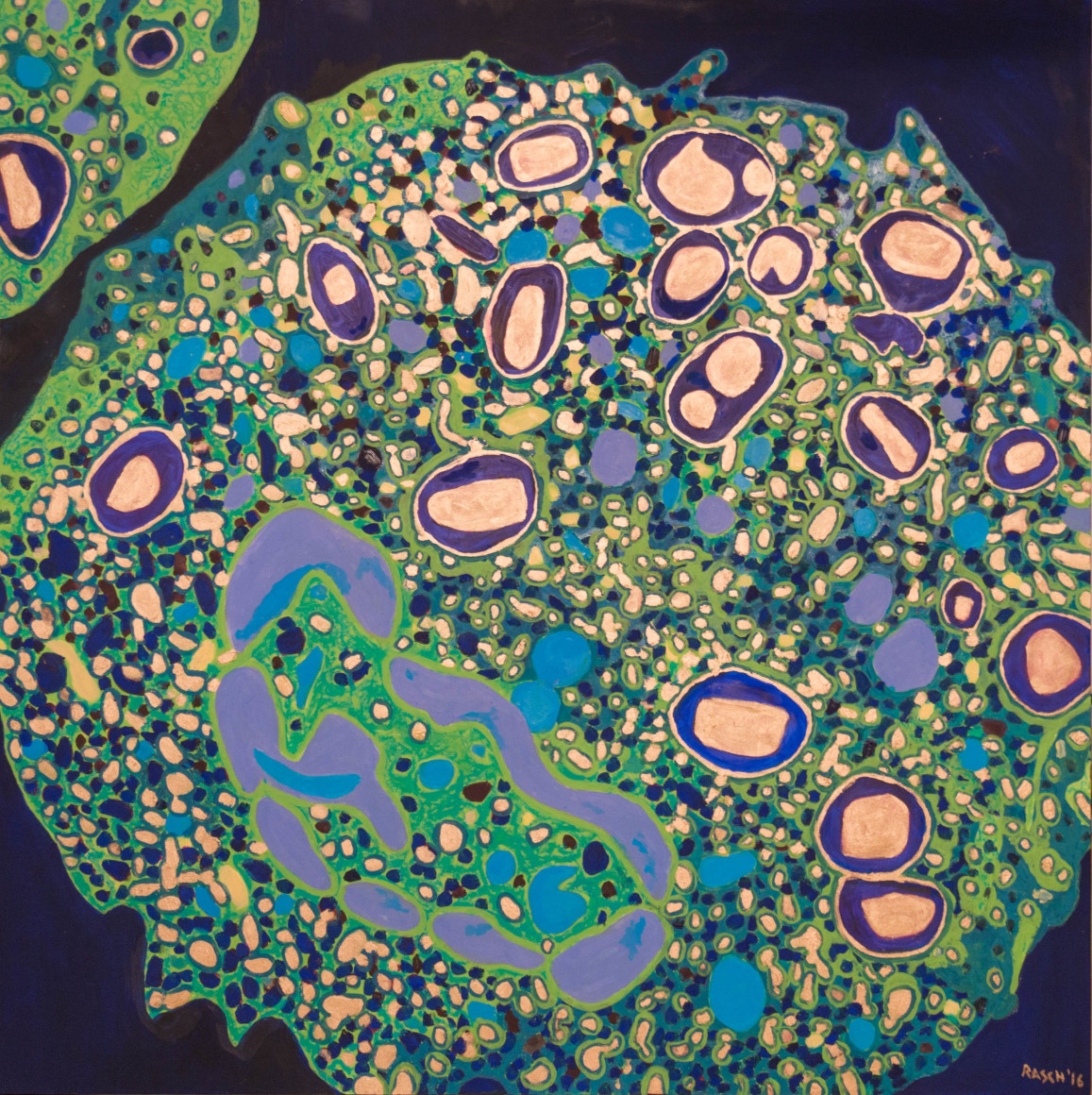 Jody Rasch, Healing - White Blood Cell 3