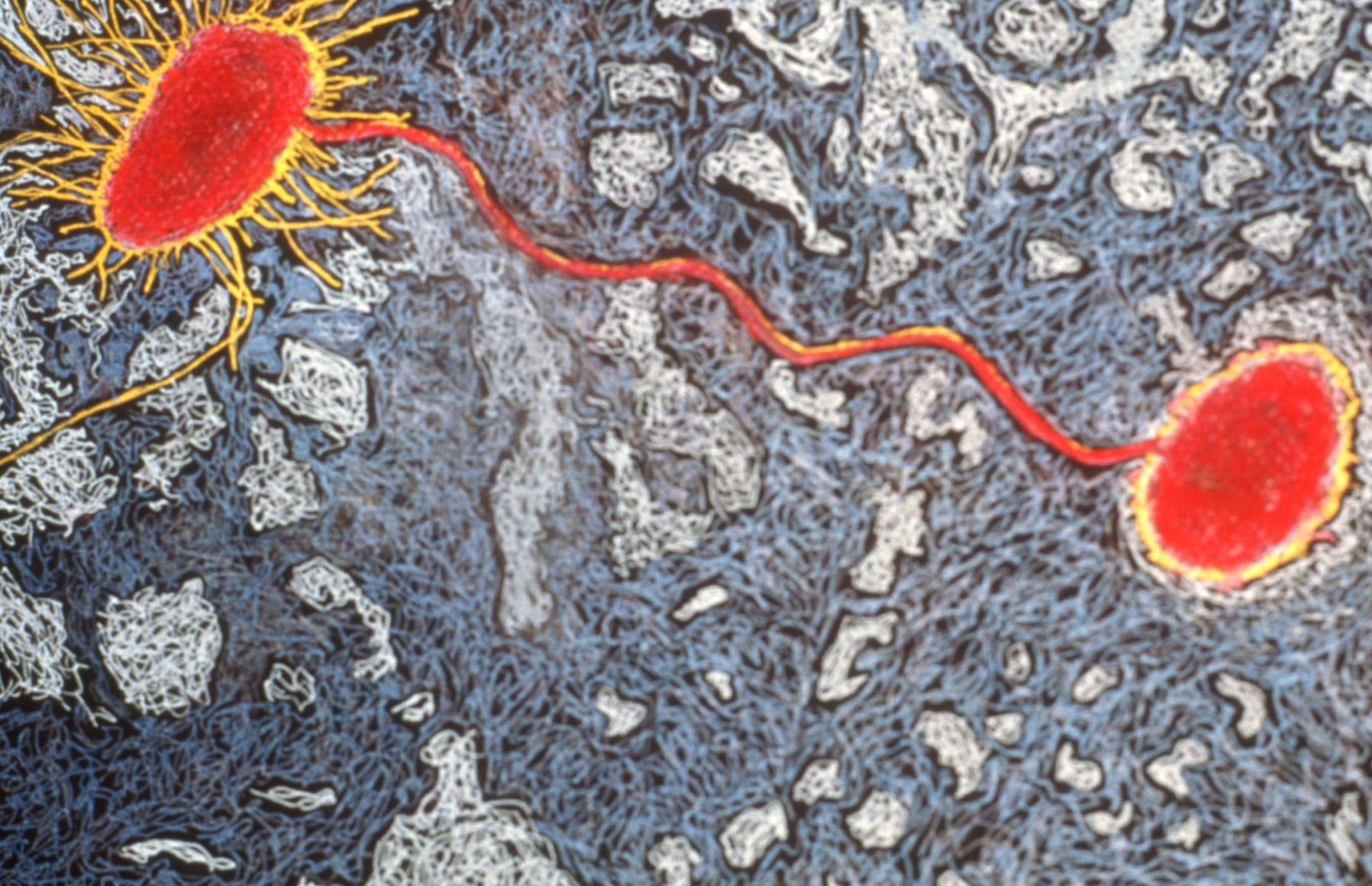 Jody Rasch, Flora - E-coli, 2002