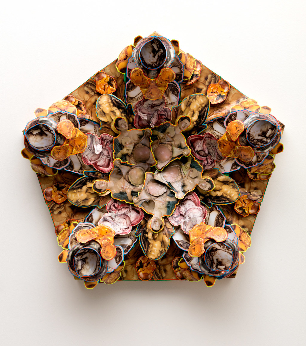 Patrick Turk, Manifold Pains, 2015