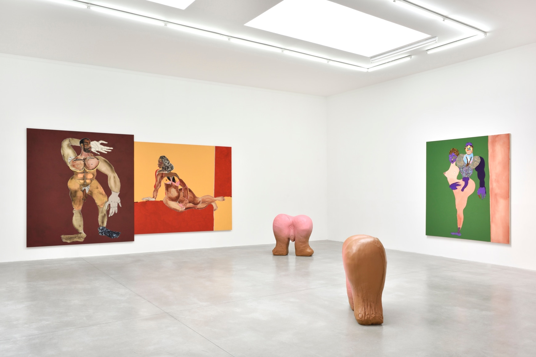 Installation view, Tschabalala Self, Make Room, Le Consortium, Dijon, 2022