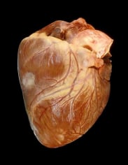Angela Strassheim, Cancer Heart (Detail from Hearts)