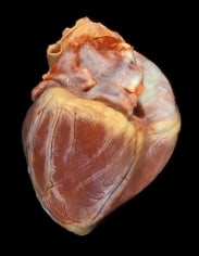 Angela Strassheim, Childs Healthy Heart (Detail from Hearts)