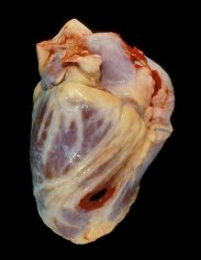 Angela Strassheim, Shot in the Heart (Detail from Hearts)
