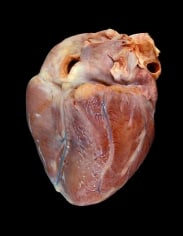 Angela Strassheim, Teenage Drug Overdose Heart (Detail from Hearts)