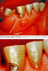 Peter Drake M/oral Pathology IX, Multiple Pathologies, 2007
