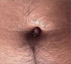 Ham Jin. Aewan #1015, 2004. C-print photograph of polymer clay sculpture on the artist&#039;s belly button, Size of photo: 155 x 125.5 cm, size of sculpture: 1 cubic cm (approximate).&nbsp;Courtesy of the artist &amp;amp; PKM Gallery.